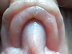 Free-FreePorn.com presents: Clitoris close-up